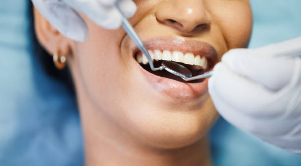 Best Emergency Treatment for Dental Infections or Abscesses in Southaven, MS